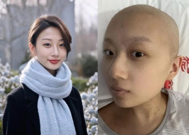 궈장이 AI로 모습을 바꾼 사진(왼쪽)과 암 투병 중인 현재 모습. 궈장 웨이보 캡처