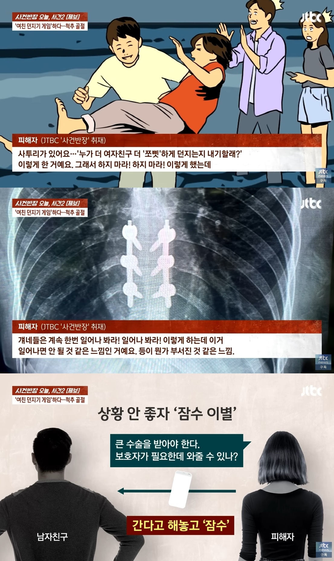 한 여성이 해수욕장에서 물놀이를 하던 중 남자친구의 ‘여친 던지기’ 놀이에 척추가 골절돼 전치 14주의 중상을 입었다. 자료 : JTBC 사건반장