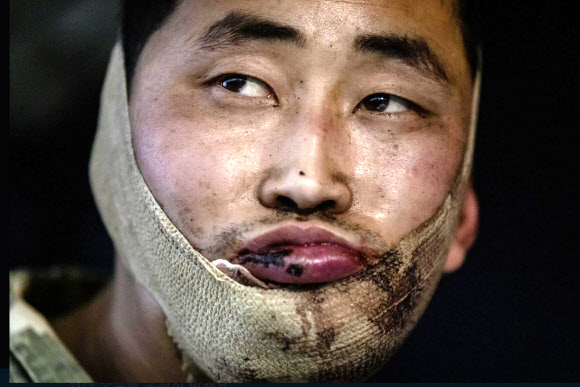 볼로디미르 젤렌스키 우크라이나 대통령은 11일(현지시간) 우크라이나군이 러시아 서부 쿠르스크 지역에서 북한 군인 2명을 생포했다고 밝혔다. 젤렌스키 대통령은 이날 텔레그램 채널에 글을 올려 생포된 북한 병사 2명이 다친 상태로 키이우로 이송됐으며 우크라이나 보안국(SBU)의 심문을 받고 있다고 전했다. 2025.1.12  젤렌스키 엑스 캡처