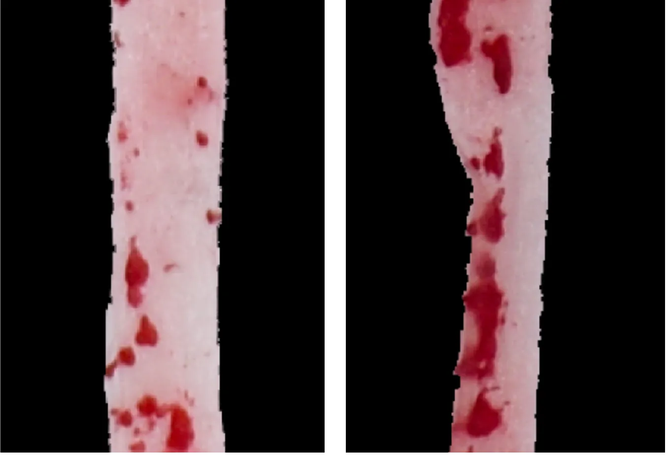 아스파탐을 먹은 쥐(오른쪽)는 감미료를 전혀 섭취하지 않은 쥐에 비해 동맥에 지방 찌꺼기(빨간색)가 더 크고 더 많이 생긴 것이 관찰됐다.

셀 메타볼리즘 제공