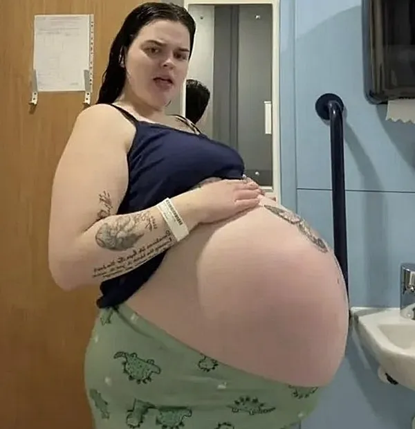 양수과다증으로 배가 과다하게 부풀어 오른 로렌의 모습. 출처=더선, 틱톡