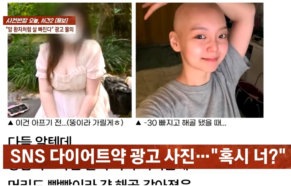 암 투병 중인 A씨가 “내 사진이 다이어트 보조제 광고에 도용당했다”며 한 업체의 소셜미디어(SNS) 광고를 국민신문고와 공정거래위원회에 신고했다. 자료 :  JTBC 사건반장