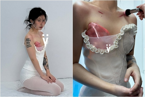 ‘폴란드 증후군’으로 인해 보석으로 만든 보형물을 착용한 쉬안씨. 보석 디자이너 이브민 SNS 캡처