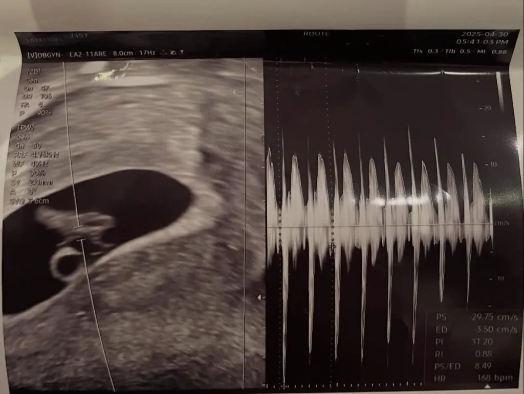 ‘하트시그널3’ 출신 서은우(32·개명 전 서민재)가 임신 소식을 전했다. 서은우 인스타그램