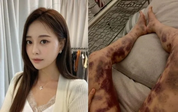 아옳이(김민영) 인스타그램