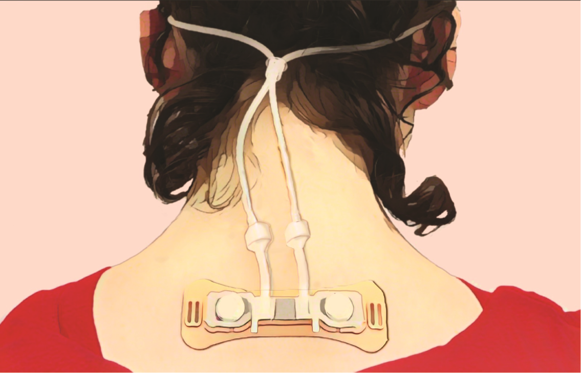 목 뒤에 부착한 장치로 비강 호흡 패턴을 측정한다. 연구팀은 호흡 패턴을 바꾸면 정서적 상태도 바꿀 수 있을 것으로 기대하고 있다. 이를 위해 좀 더 착용이 편한 웨어러블 측정 장치를 개발 중이다.

이스라엘 바이츠만 과학연구소 제공