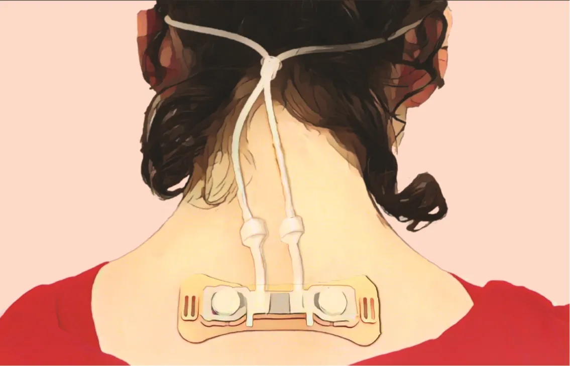 목 뒤에 부착한 장치로 비강 호흡 패턴을 측정한다. 연구팀은 호흡 패턴을 바꾸면 정서적 상태도 바꿀 수 있을 것으로 기대하고 있다. 이를 위해 좀 더 착용이 편한 웨어러블 측정 장치를 개발 중이다.

이스라엘 바이츠만 과학연구소 제공