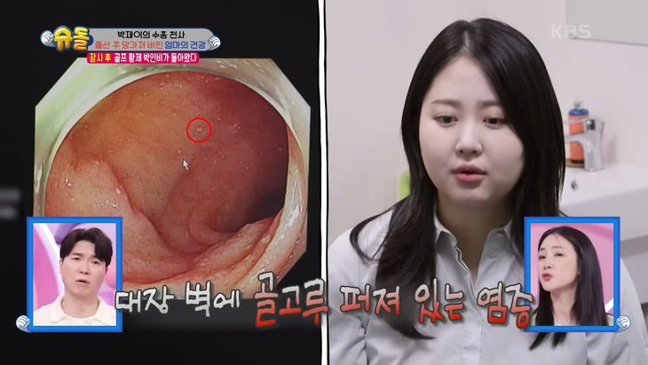방송인 박수홍의 아내 김다예가 30kg을 감량했다. KBS2 ‘슈퍼맨이 돌아왔다’ 방송화면