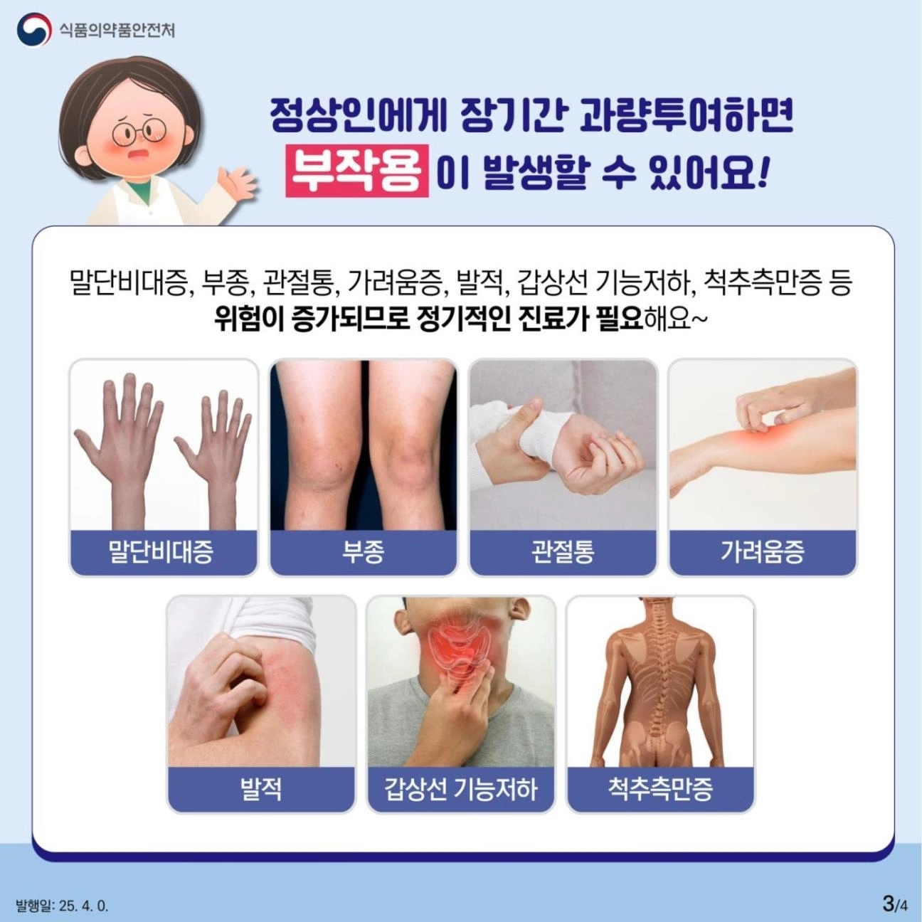 성장호르몬 치료제를 정상인에게 장기간 과량투여하는 경우 거인증, 말단비대증 등 부작용이 발생할 수 있다. 식약처 제공