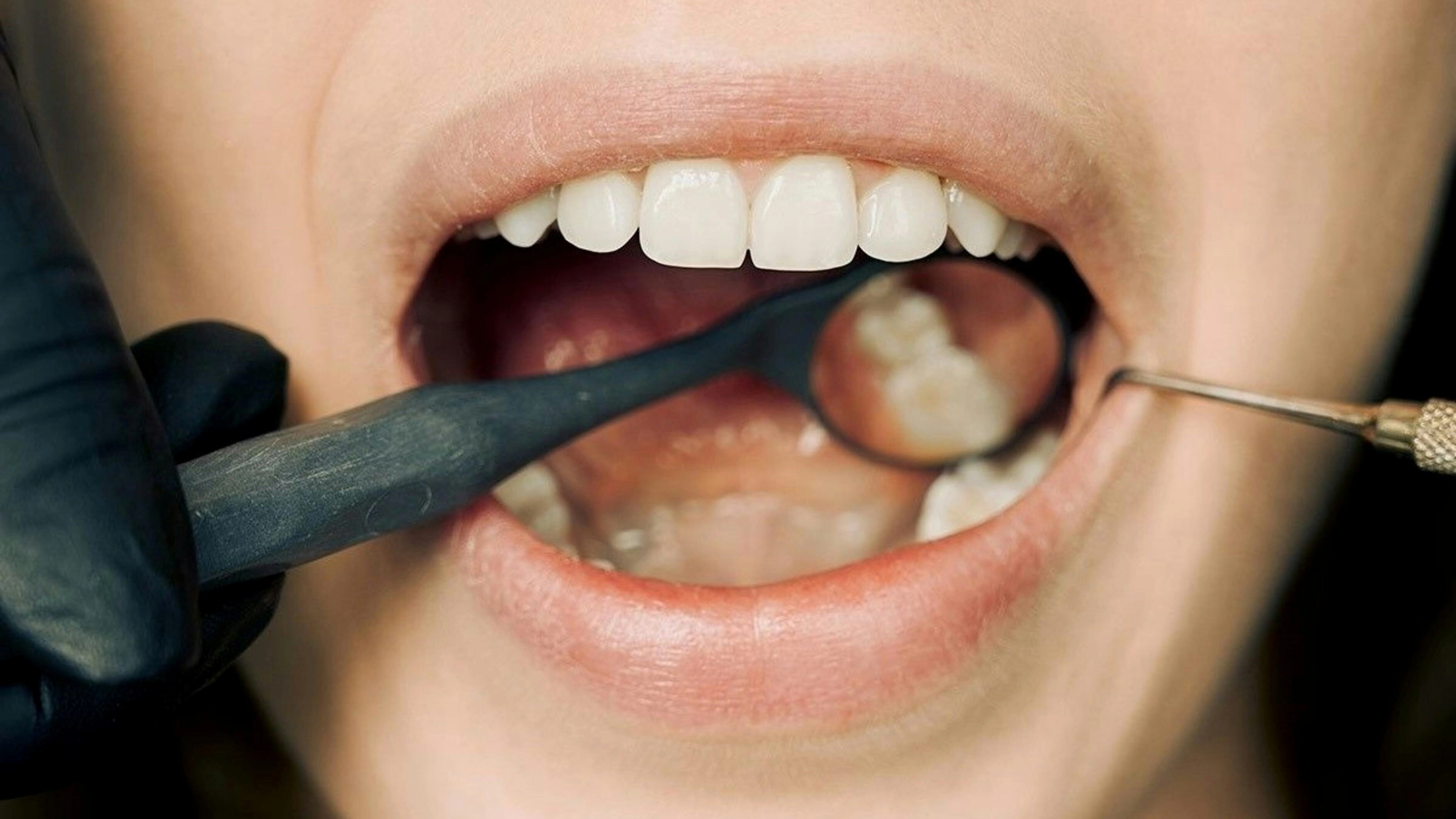 치과 검진. 펙셀스