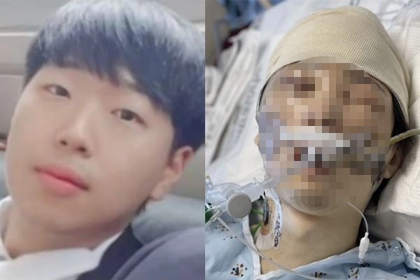 윤세준씨. 오른쪽은 미국 로스앤젤레스에서 윤씨로 오인됐던 남성. KBS 뉴스화면 캡처, LA 보건당국