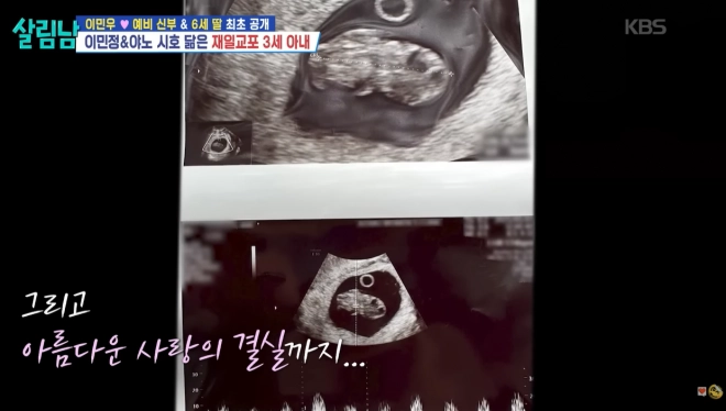 KBS 2TV ‘살림하는 남자들 시즌2’ 방송화면 캡처
