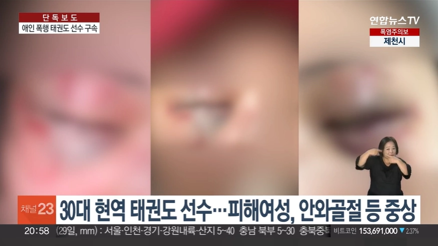태권도 사범인 30대 남성으로부터 폭행을 당한 여자친구 B씨의 상처 부위 모습. 연합뉴스TV 보도화면 캡처