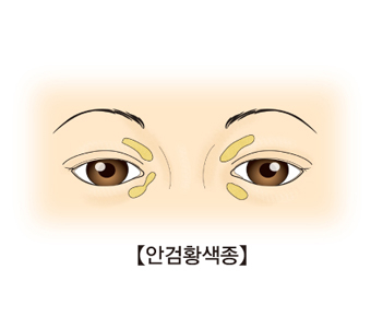 서울아산병원 제공