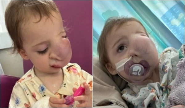 영국에서 1세 여아가 희귀 연조직암으로 사망했다. ‘고 펀드 미(Go Fund Me)’ 캡처