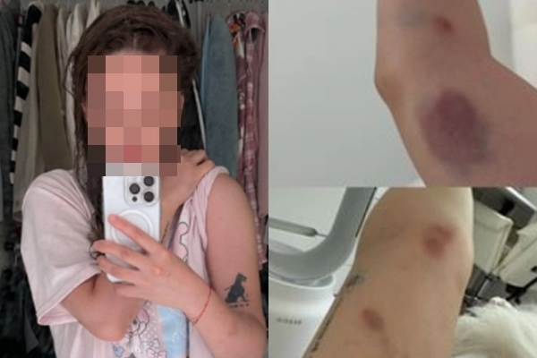 유튜버로 활동하는 대만인 여성이 서울 홍대 거리를 걷다 처음 보는 남성들의 헌팅을 거절한 뒤 폭행당했다며 사진을 공개해 논란이 일고 있다. 인스타그램 캡처