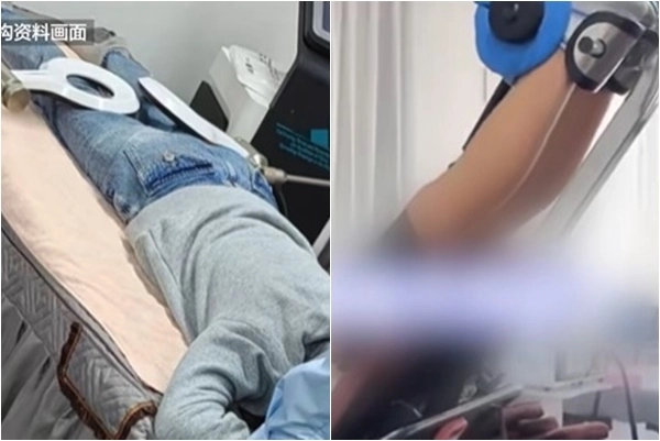 중국의 한 10대 소년이 신장 연장 치료로 6개월 만에 1.4㎝ 성장했지만, 치료 중단 2주 만에 원래 키로 되돌아간 사연이 전해졌다. 베이징뉴스 영상 캡처