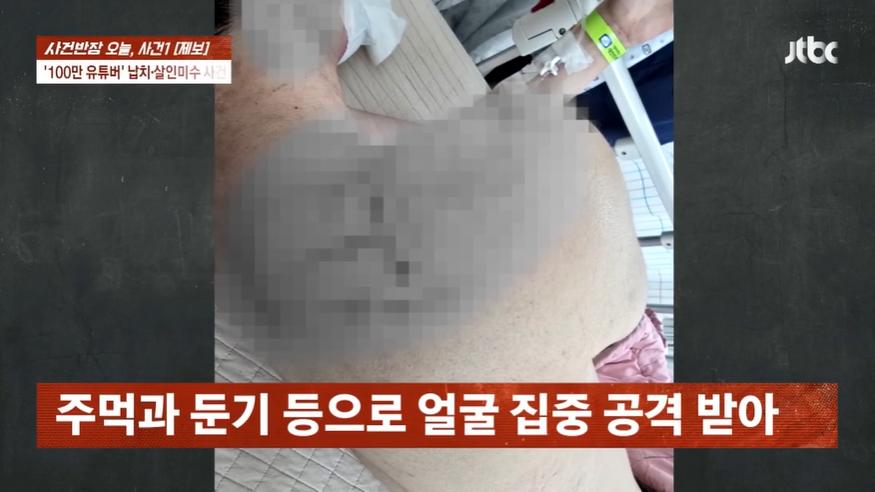 인천의 한 아파트 지하주차장에서 남성 2명에게 납치·폭행당한 유명 유튜버 수탉이 병원에서 치료받고 있는 모습. JTBC ‘사건반장’ 보도화면 캡처