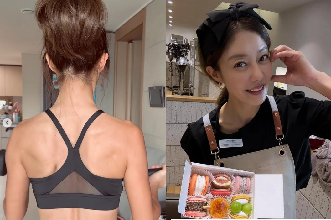 그룹 쥬얼리 출신 방송인 이지현이 백반증 투병 사실을 고백했다. 이지현 인스타그램 캡처