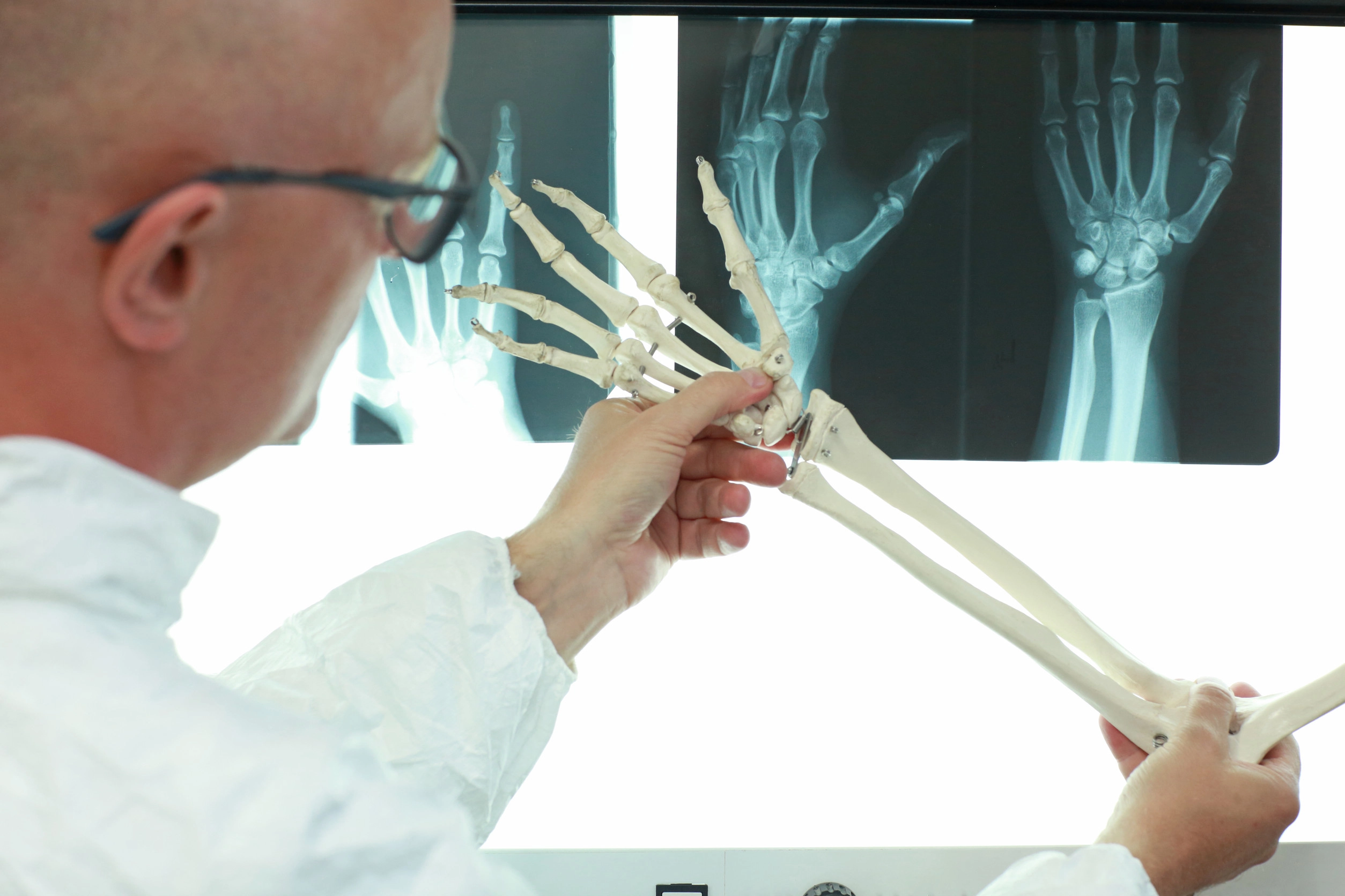 손 뼈를 관찰하는 모습. 123rf