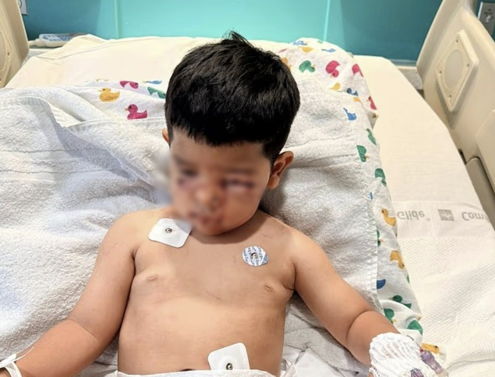 미국의 한 가정집에서 이웃집 개가 문을 두드려 열어줬다가 3살 아들이 얼굴 등을 크게 물리는 사고가 발생했다. 알렉스 카페틸로 페이스북 캡처