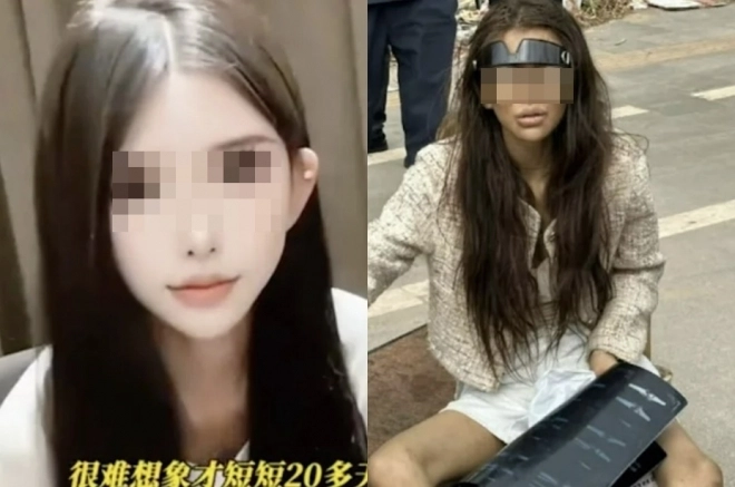 중국 푸젠성 출신의 한 여성 인플루언서가 지난해 12월 캄보디아의 한 길거리에서 발견됐다. 이 여성은 ‘고임금 일자리’가 있다는 말에 속아 캄보디아로 넘어왔으며, 주캄보디아 중국 대사관의 도움을 받아 병원에서 치료받고 귀국을 준비하고 있다. 자료 : 중국 소셜미디어(SNS)