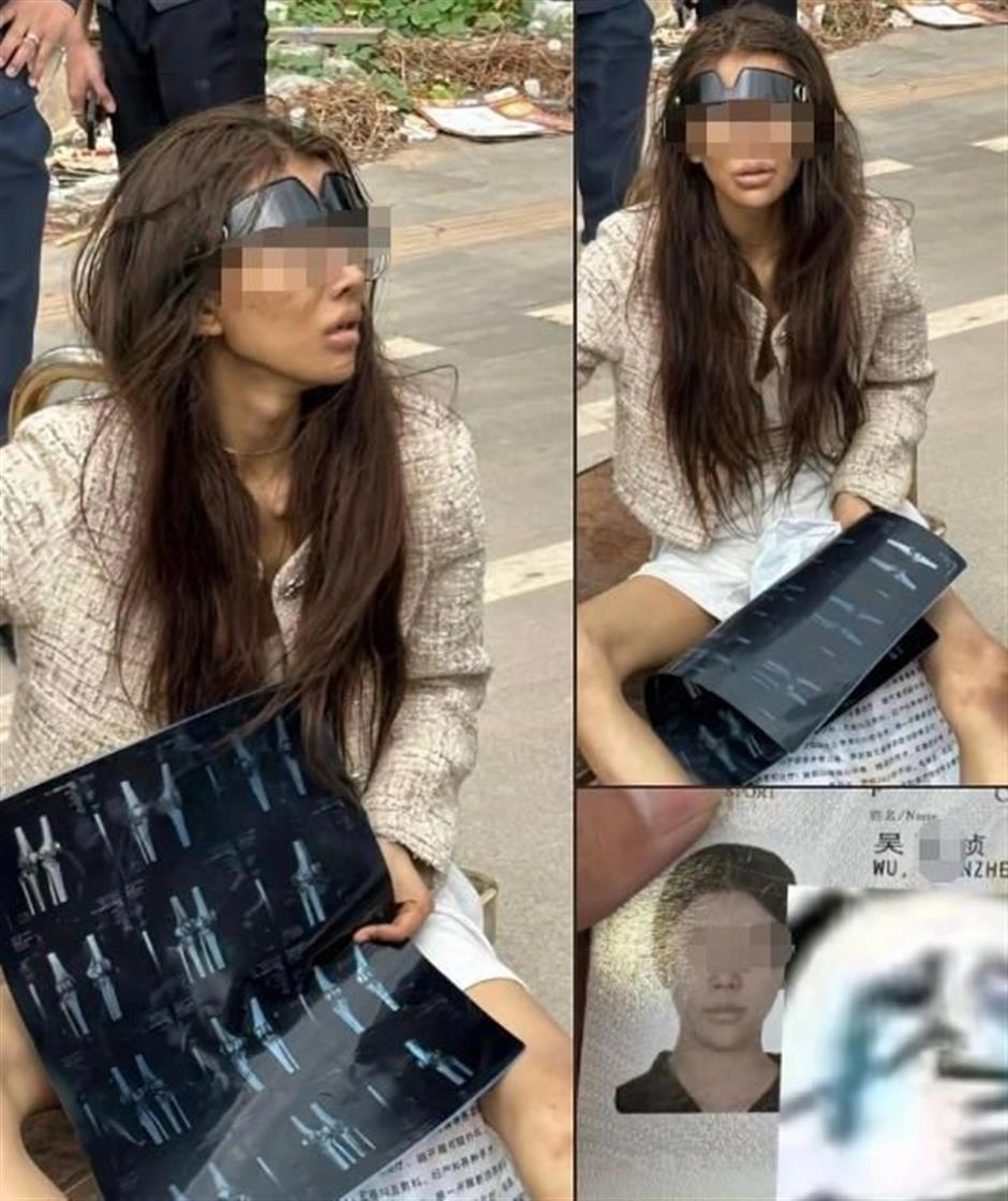 6일(현지시간) 크메르타임스와 네이션 등에 따르면 지난 3일 캄보디아 남부 시아누크빌 주재 중국 영사관은 현지 한 병원에서 자국의 20대 여성 인플루언서 ‘우미’를 발견했다. 팔로워 수만명을 보유한 우미는 중국 남동부 푸젠성의 고급 클럽에서 일하면서 온라인에 호화로운 생활 방식을 자랑해오다, 지난달 초 캄보디아에서 일하는 중국인 남자친구가 자신을 초대했다고 밝힌 뒤 출국했다. 2025.1.5 SNS 캡처