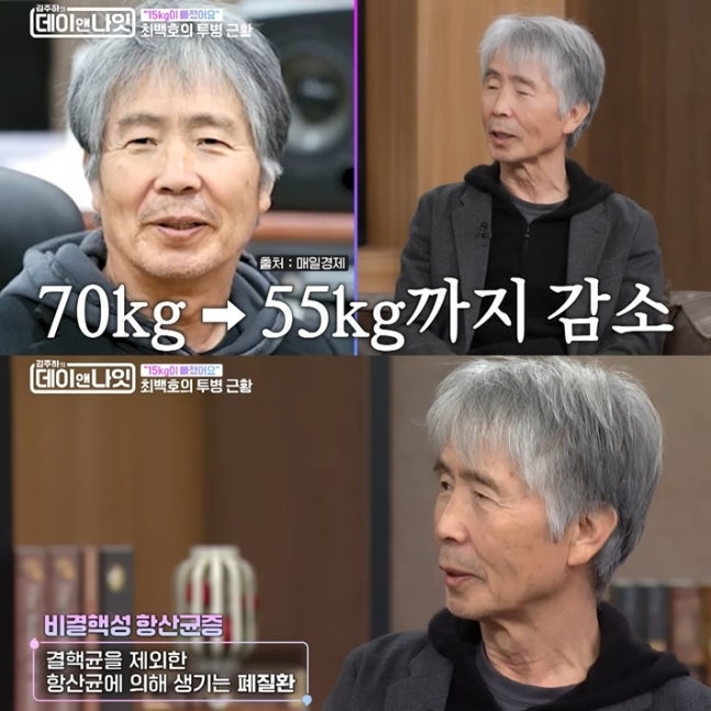 가수 최백호가 현재 건강 상태를 털어놓았다. MBN ‘김주하의 데이앤나잇’