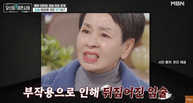배우 이미영이 공업용 실리콘으로 입술 시술을 받았다가 고통을 겪었던 일화에 대해 털어놨다. MBN ‘당신이 아픈 사이’ 캡처