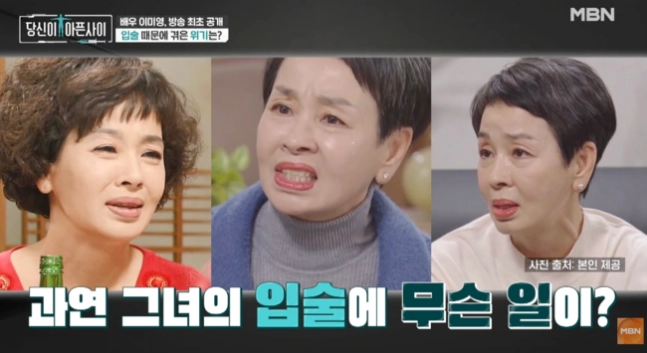 배우 이미영이 공업용 실리콘으로 입술 시술을 받았다가 고통을 겪었던 일화에 대해 털어놨다. MBN ‘당신이 아픈 사이’ 캡처
