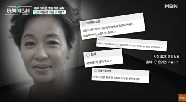 배우 이미영이 공업용 실리콘으로 입술 시술을 받았다가 고통을 겪었던 일화에 대해 털어놨다. MBN ‘당신이 아픈 사이’ 캡처