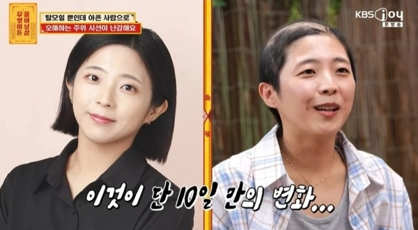 KBS조이 예능 ‘무엇이든 물어보살’ 방송화면 캡처