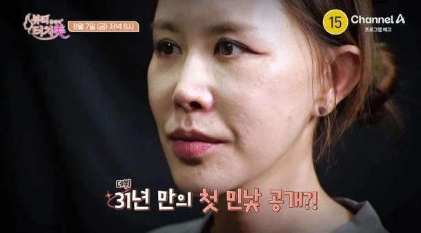 채널A ‘뷰티클리닉 터치미’
