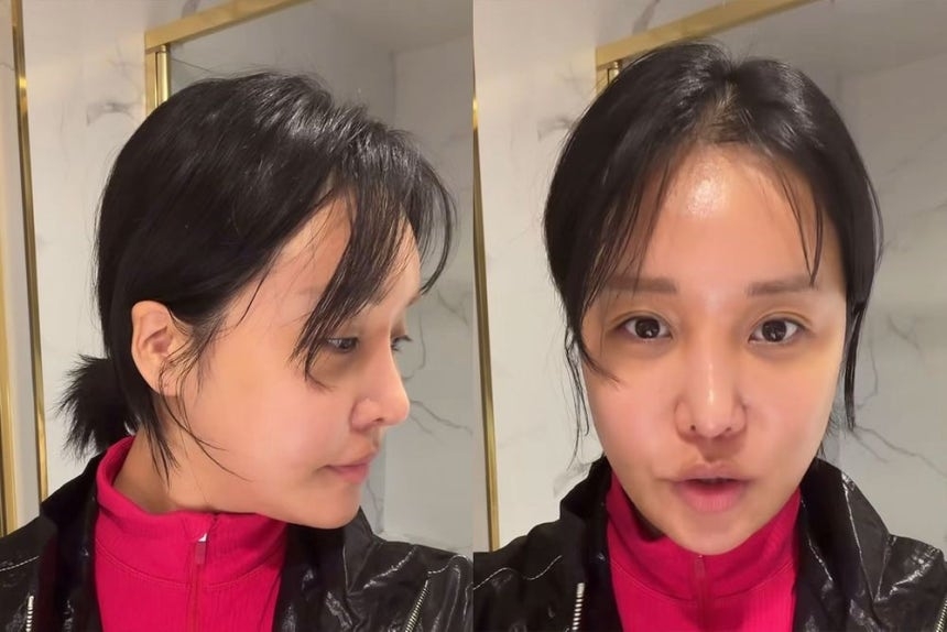 방송인 랄랄은 최근 눈밑 지방 재배치 시술과 코 수술을 받았다고 밝혔다. 랄랄 인스타그램