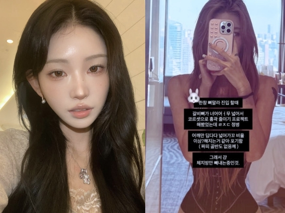 갈비뼈 억지로 줄이려 흉곽 코르셋 찼다는 최준희… ‘뼈말라’ 위험천만 경고