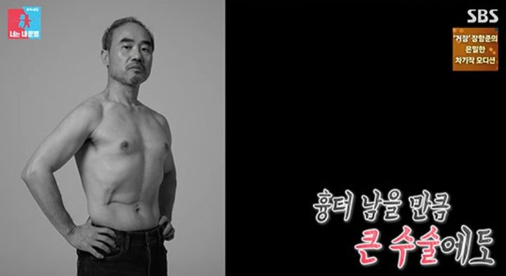 배우 강신일이 간암 진단을 받고 수술한 지 2주 만에 활동을 재개해야만 했던 사연을 털어놨다.  SBS ‘동상이몽 2-너는 내 운명’ 캡처