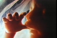 내년부터 다둥이 출산 산모 태아당 100만원 의료비