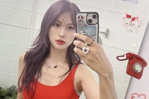 카라 박규리, 광대·안와골절 수술 앞두고 SNS 심경글 “기도해줘요”
