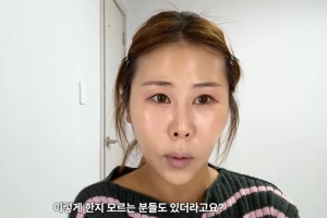 “중3 때 내 얼굴 본 엄마, 화들짝 놀라서…” 박세미, 쌍꺼풀 수술한 사연