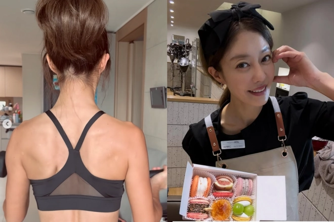 “온몸에 ‘이것’ 빼곡해”…이지현, 난치병 투병 고백