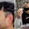 thumbnail - 김수용 귓불주름, 심근경색 징조 아니었다?…“사실은 ‘이것’ 때문”