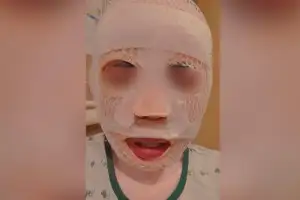 thumbnail - “다른 남자 만날까 봐” 태국인 아내 얼굴에 ‘끓는 물’ 부은 한국인 남성 검거