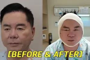 “안면거상 수술로 얼굴 싹 고쳐” 충격…‘67세’ 심형래, 대체 무슨 일?