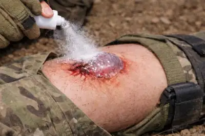 thumbnail - 뿌리면 1초 만에 지혈…韓연구진이 개발한 ‘파우더 지혈제’ 정체