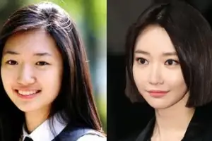 “나도 눈 했어!” 고준희, 당당한 성형 고백…과거 사진 보니