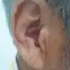 thumbnail - 늙어서 생겼나 했던 귓불 주름, 뇌혈관 손상 때문? “위험신호일 수 있어”