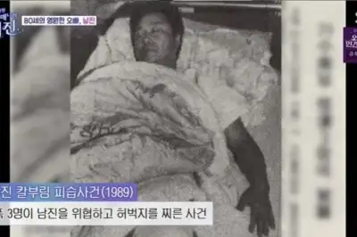 thumbnail - 남진, 조폭 3명에 피습당해… “뒤에서 찔러 허벅지 관통”