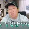 “나 성형남이야” 정형돈, 달라진 외모에 만