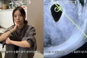 thumbnail - 김지영, 임신 7주차에 갑작스러운 낙상사고…눈물 쏟았다
