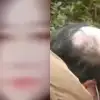 thumbnail - “탈모 생기니까 남편이 이혼하자네요” 30대女 ‘충격 사연’…결말은